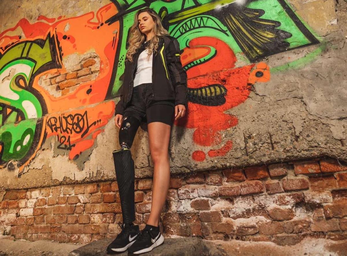 Ispovest Marije Matić koja je zbog tumora ostala bez noge, a danas je ...