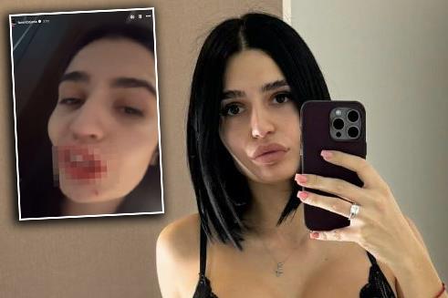 Tamara Bojanić pretučena | Kurir