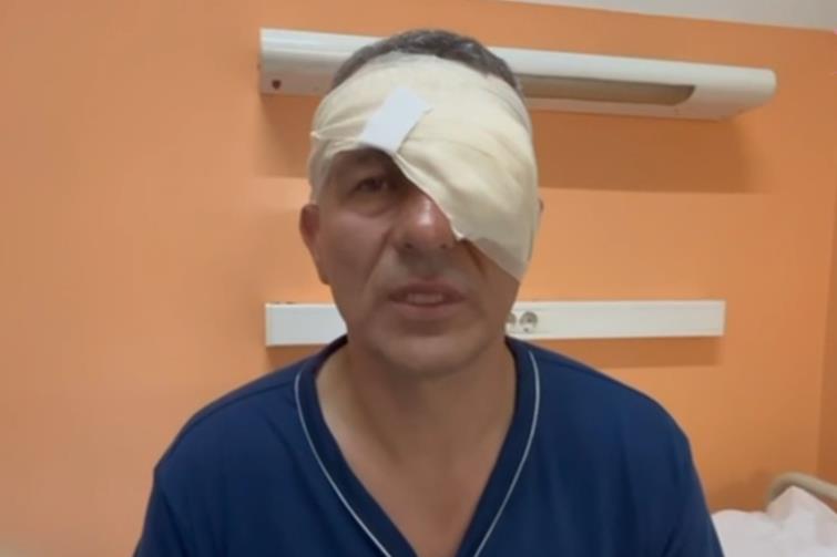 "OD SILINE UDARCA SAM U TRENUTKU IZGUBIO SVEST" Žandarm Lazar Baćić kome je krvnički razbijeno oko se oglasio iz bolnice: Otkrio kako se sve odigralo (FOTO)