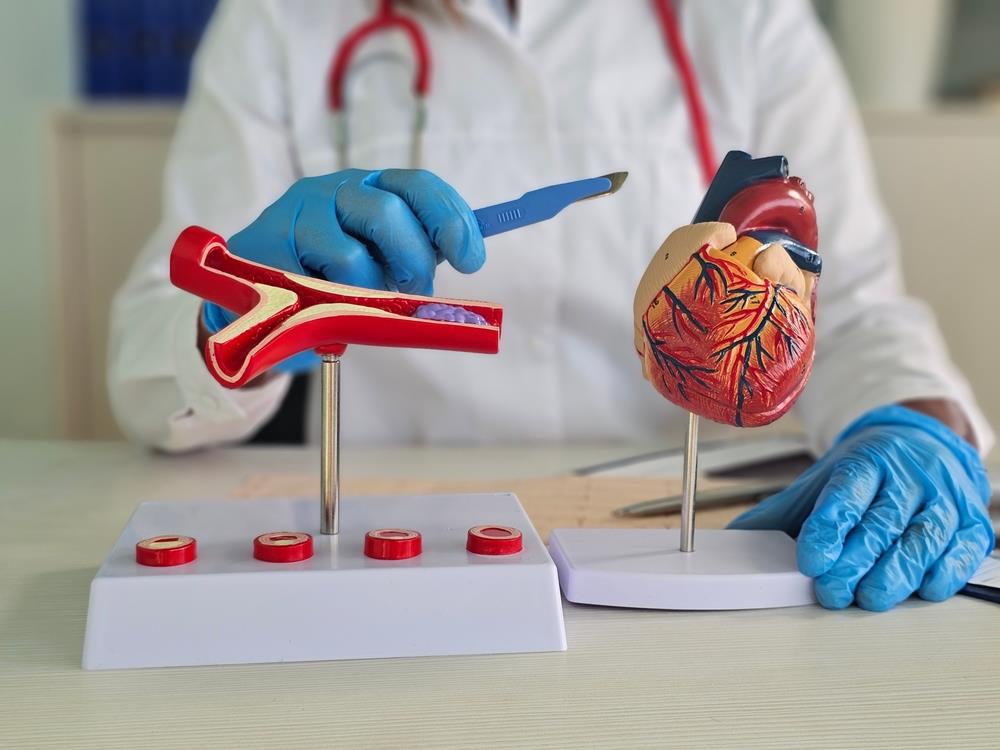 Šta je totalna arterijska bajpas operacija? | Zdravlje Kurir