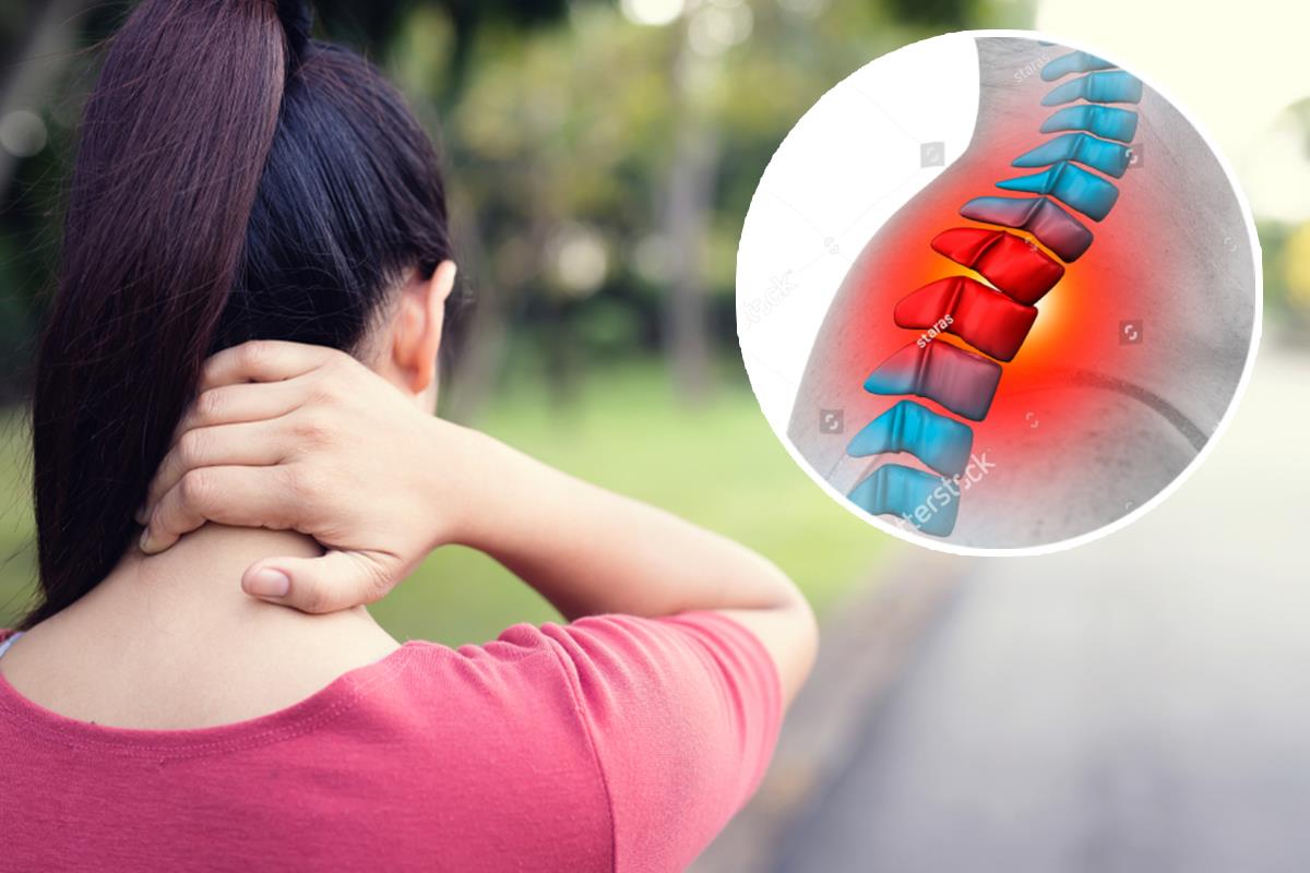 Why Does a Hump Appear Behind the Neck? These Exercises Help Relieve the Problem