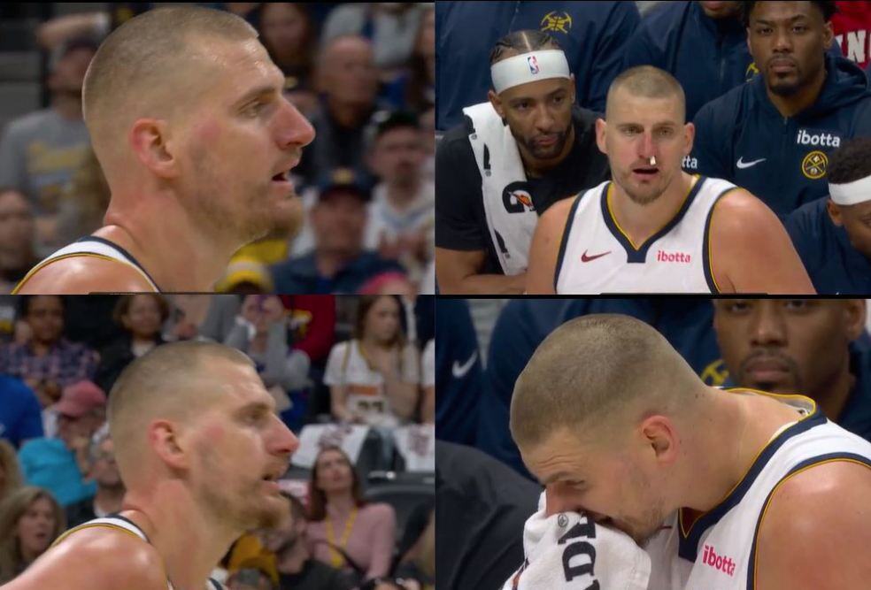 HORRIFIC SCENES! Nikola Jokic Injured Again: Bloody Scene on the Court! (VIDEO)