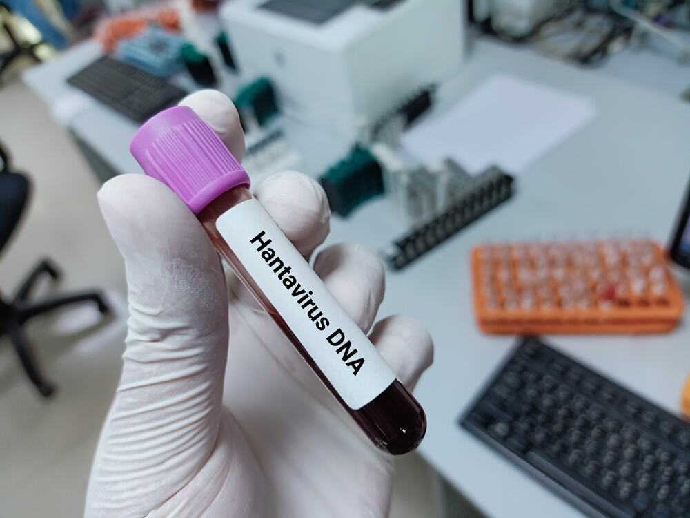 Hantavirus is also present in Serbia: Batut urgently warns about deadly infection