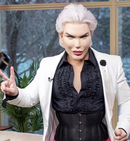 IMAO JE PREKO 60 OPERACIJA: Ljudski Ken želi da mu Barbika rodi dete ...
