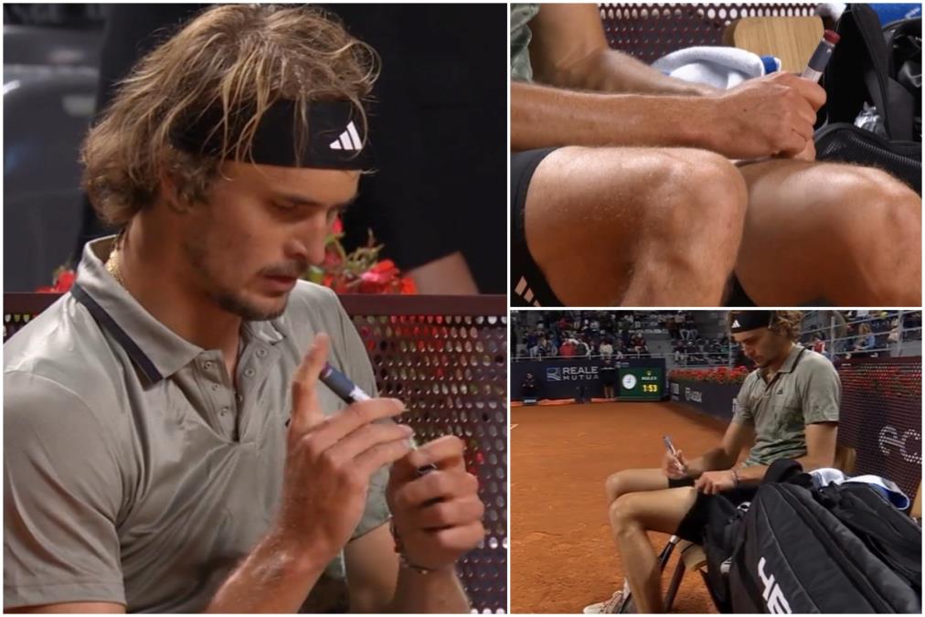 ZVEREV GODINAMA SKRIVAO NEIZLEČIVU BOLSET! Ismevali su ga, k