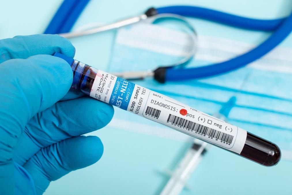 VIRUS ZA KOJI NEMA VAKCINE ŠIRI SE EVROPOM Daleko najviše obolelih ima u komšiluku! Bolest se širi brzinom svetlosti