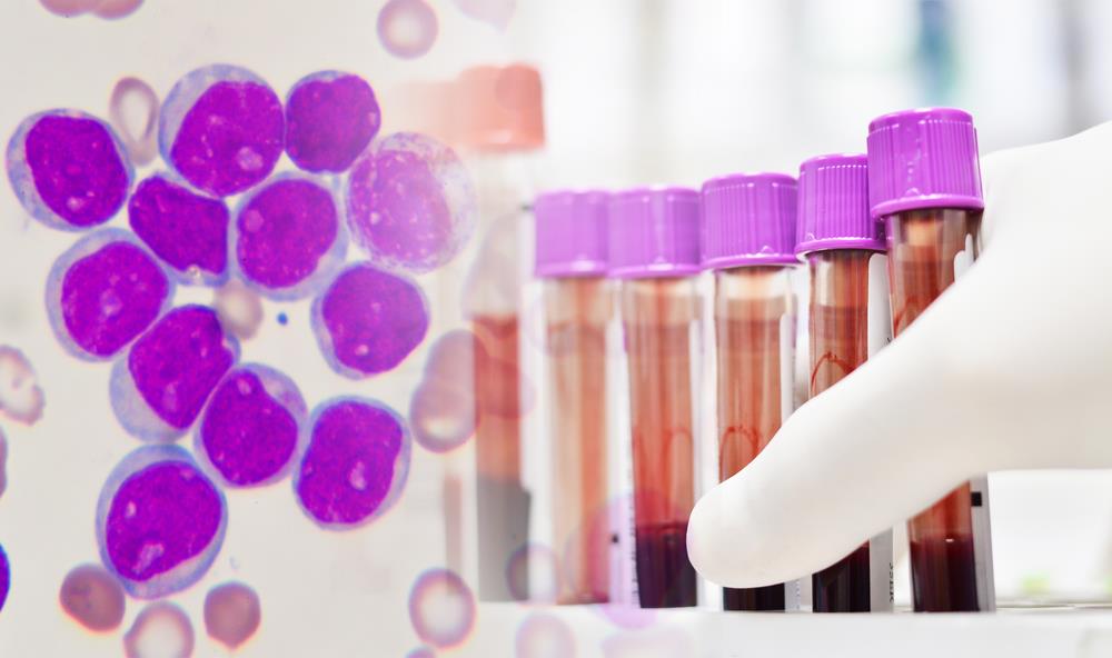 SRBIJA DOBIJA LABORATORIJU BUDUĆNOSTI ZA MATIČNE ĆELIJE I NOVU MEDICINU: Profesor otkrio kakve terapije bi uskoro mogle da budu dostupne pacijentima u Srbiji