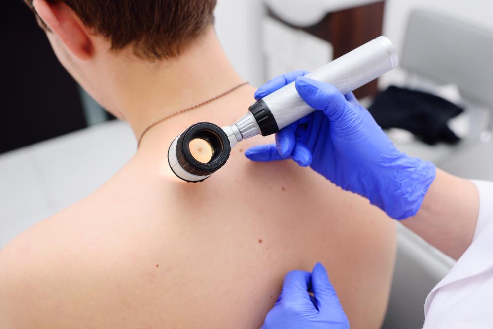 Velika akcija preventivnih pregleda kože: Dermatolozi stižu u srpske sredine na Kosovu