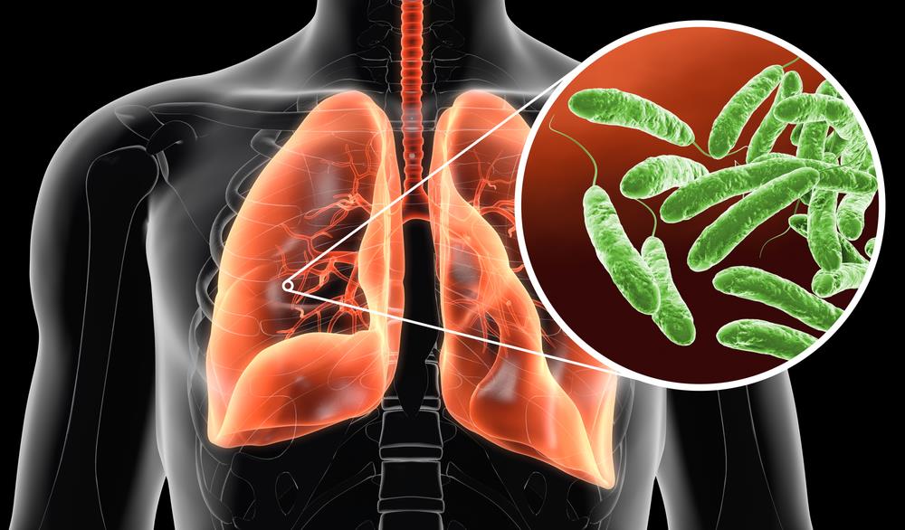 PRVI SMRTNI SLUČAJ U EPIDEMIJI OPAKE BOLESTI: U milionskom gradu izbila opaka zaraza, svi gledaju na krovove zgrada - TU JE ŽARIŠTE? Ovo su simptomi