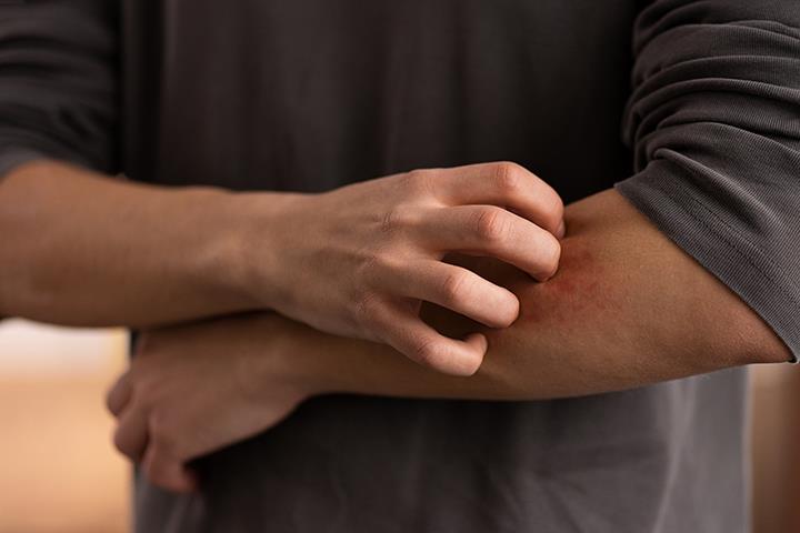 SUTRA AKCIJA SUZBIJANJA KOMARACA U BEOGRADU: Ovi delovi grada su na spisku