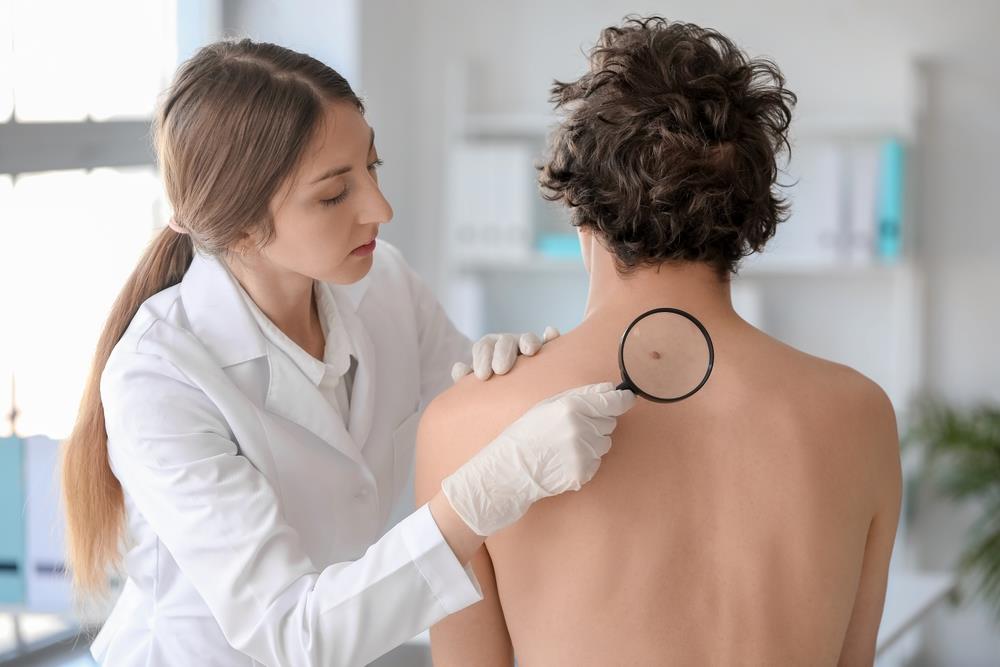 Besplatni pregledi kože do oktobra: Najviše melanoma otkriveno u Boru, jednostavan hirurški zahvat spasava život