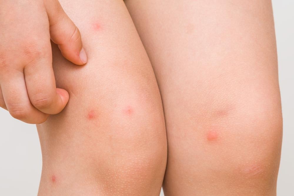 Nikad kraja dosadnim insektima: 6 biljaka koje su prva linija odbrane za napad komaraca