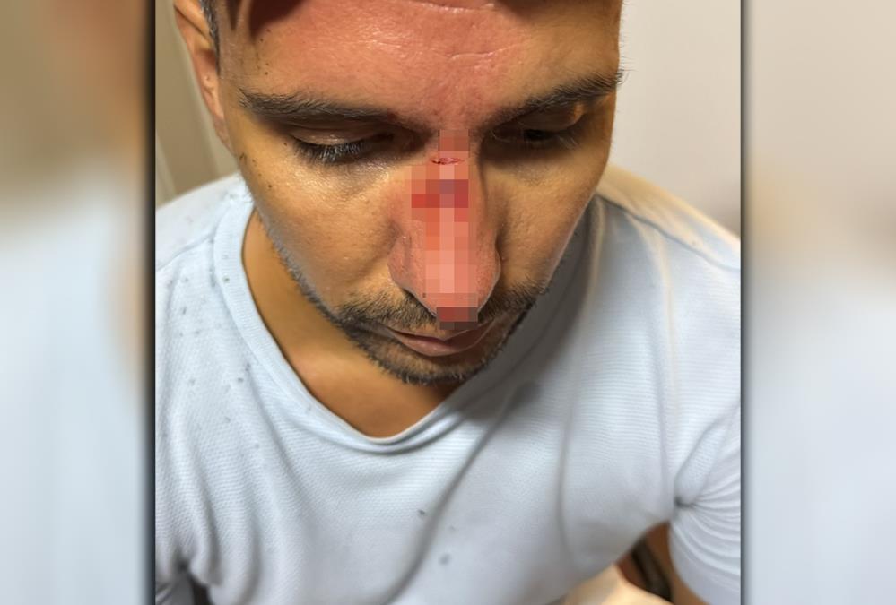 MLADIĆA POGODILI KAMENICOM U GLAVU! Još jedno jezivo nasilje blokadera u Bačkoj Palanci!