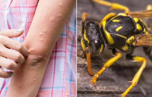 "U sekundi je krenulo gušenje!" Devojčica (13) iz Loznice se borila za život nakon uboda stršljena! Oglasila se majka
