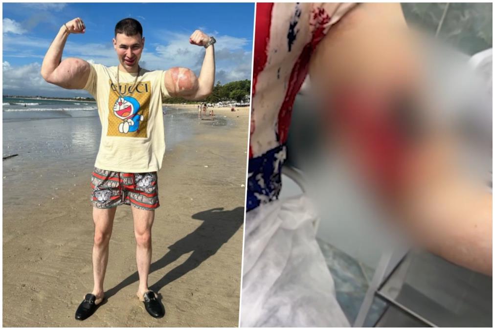 biceps-1-.jpg?ts=2025-11-24T21:50:05