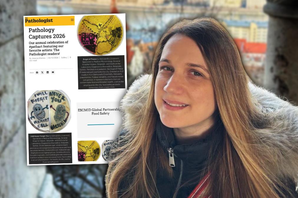 NAŠA DOKTORKA ZAVRŠILA U PRESTIŽNOM SVETSKOM ČASOPISU! Od bakterija i mikroorganizama stvorila umetnost koja leči