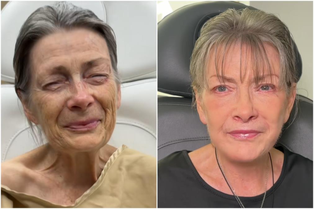 Da li verujete da je ovo ista osoba? Plastični hirurg joj promenio lični opis, ljudi u neverici gledaju slike