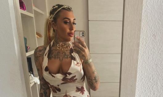 Influenserka pala s balkona hotela: Slomila kičmu na 24 mesta