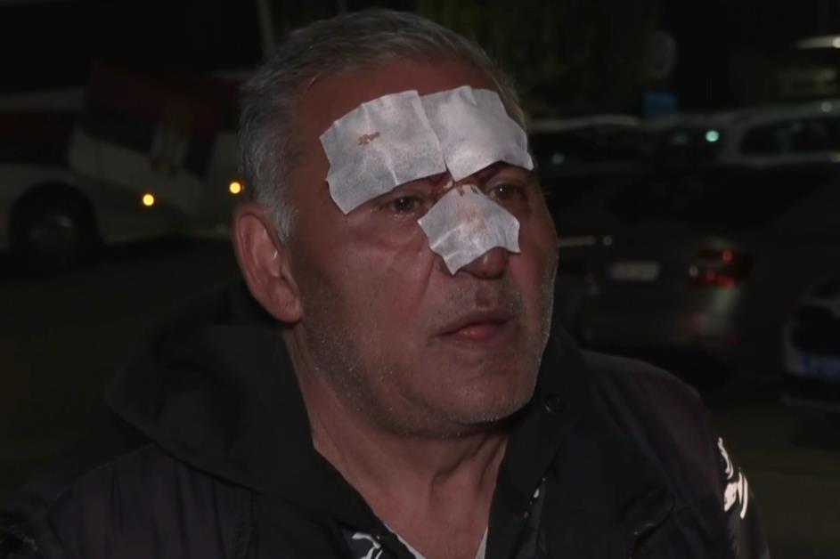 BLOKADERI BRUTALNO PRETUKLI SIMPATIZERA SNS-A U KNJAŽEVCU! Napali ga na kućnom pragu, oglasio se predsednik opštine za Kurir: 