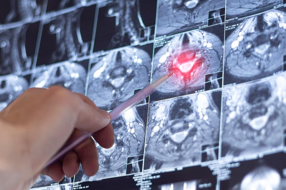 AI precizniji od lekara u hitnim slučajevima? Studija sa Harvarda pokrenula pitanja