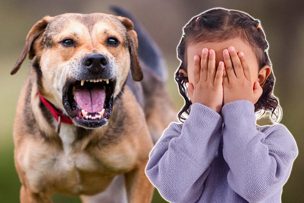 VLASNIČKI PAS IZUJEDAO PETOGODIŠNJU DEVOJČICU PO LICU I TELU! Dete zadobilo teže telesne povrede, evo šta je dovelo do stravičnog napada