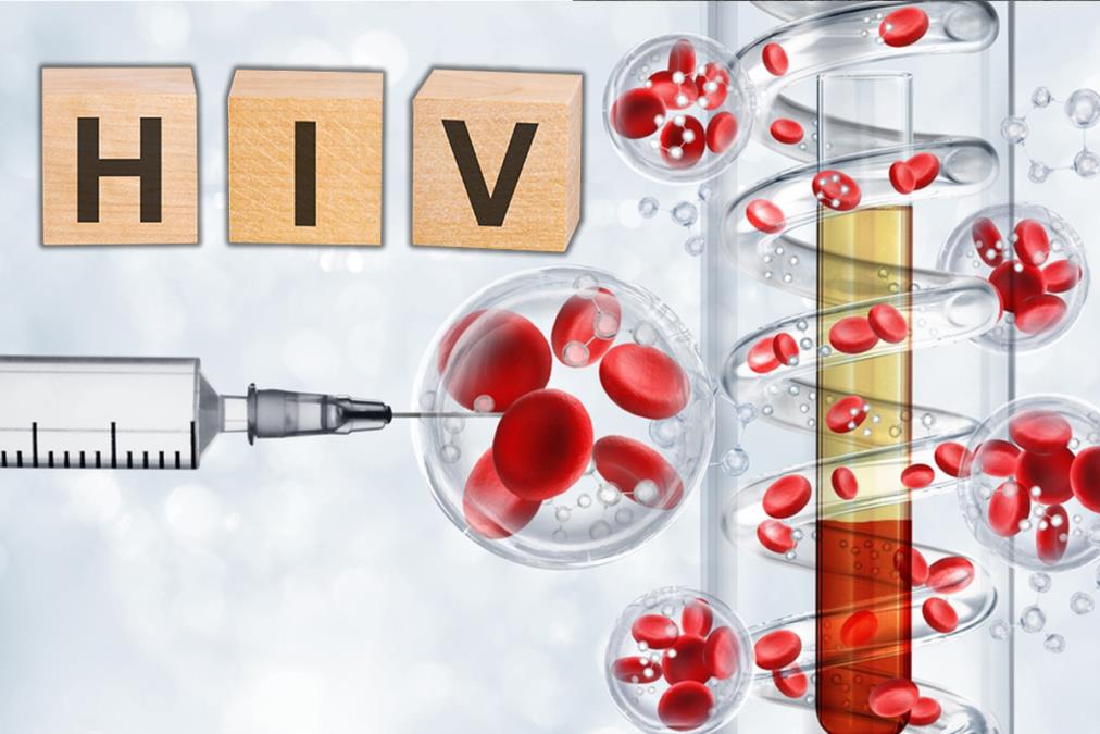 OGLASILO SE MINISTARSTVO: Broj HIV infekcija u Rusiji prepolovljen u poslednjih 10 godina