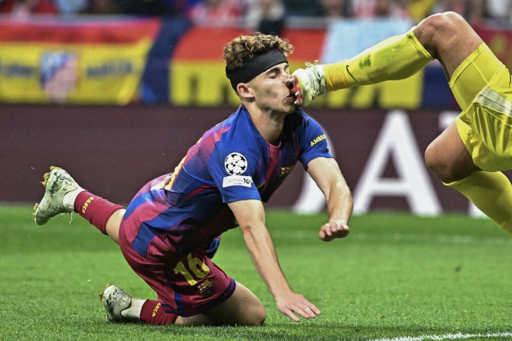 UZNEMIRUJUĆE!!! Fudbaler Barselone dobio kopačku u lice - krv lila na sve strane! Horor koji je zaprepastio čitavu Evropu! (VIDEO, FOTO)