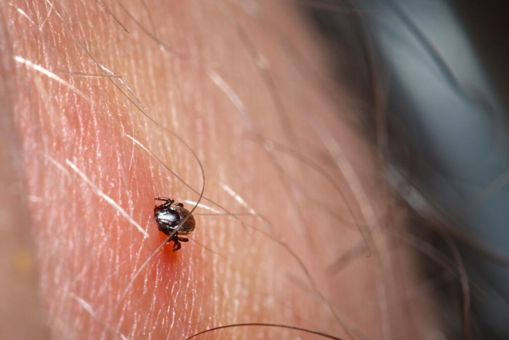 Kako bezbedno izvaditi krpelja? Narodne metode i uvrtanje u smeru kazaljke na satu mogu opasno ugroziti zdravlje
