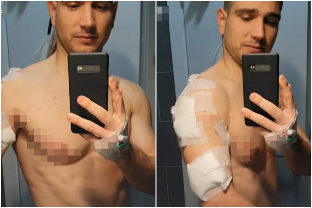 NENAD TRČAO NA FRUŠKOJ GORI PA DOŽIVEO NEZAMISLIV HOROR Srpski triatlonac krvnički napadnut: "FOTOGRAFIJE SU UZNEMIRUJUĆE"