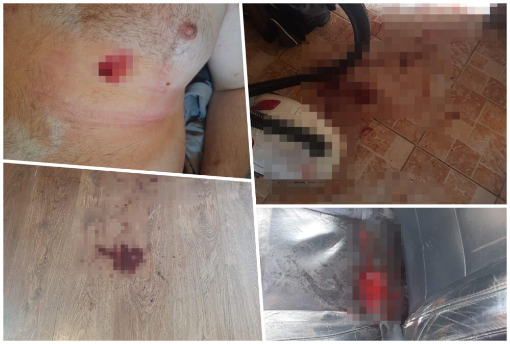 "SNIMAM OVAJ VIDEO DA POKAŽEM KOLIKO SAM OPASNA PO SEBE I PO DRUGE" Nožem izbola momka (22), pa sve zabeležila kamerom! On tvrdi: Borio sam se za život (foto)