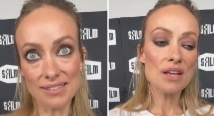 Olivija Vajld šokirala izgledom: Mršava, izbečena, sa ogromnim podočnjacima "Šta joj se dogodilo?"