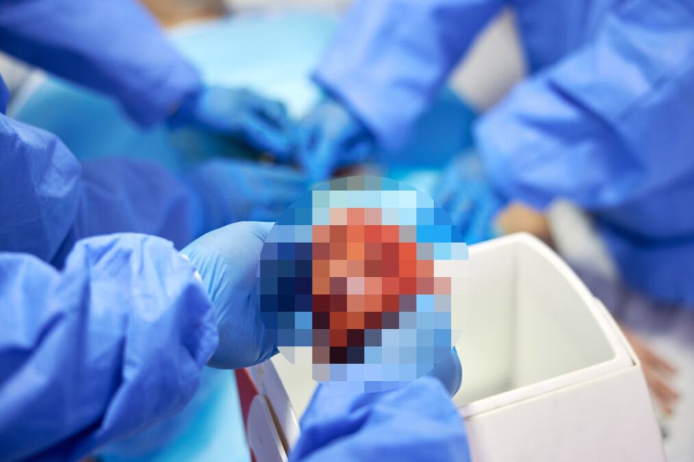 Izmene zakona: Nova pravila o doniranju organa nada su za 1.700 pacijenata koji čekaju transplantaciju