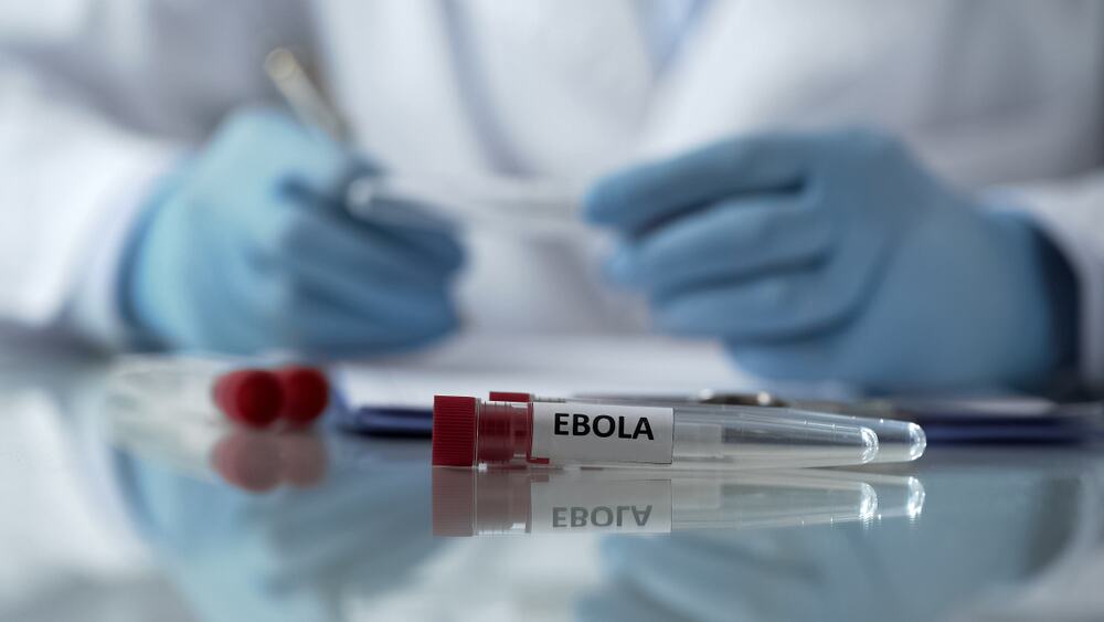 NOVI SLUČAJEVI EBOLE U EVROPI: Virus ima vrlo visok potencijal da se brzo proširi