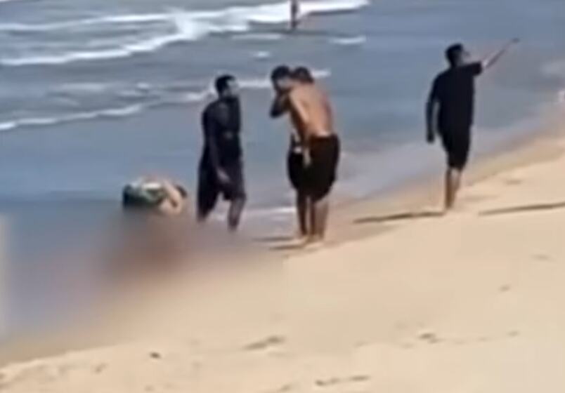 (UZNEMIRUJUĆI VIDEO) Ajkula otkinula LEVU NOGU dečaku (11) u vodi pored prepune plaže kupača, mališan molio uplakanog STRICA i spasioce da ga NE PUSTE DA UMRE! 