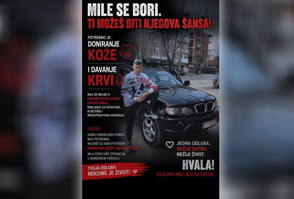 MILE ZADOBIO TEŠKE OPEKOTINE U POŽARU, POTREBNI SU MU KRV I KOŽA DA BI PREŽIVEO: Majka mladića apluje na sve dobre ljude da pomognu njenom sinu (foto)