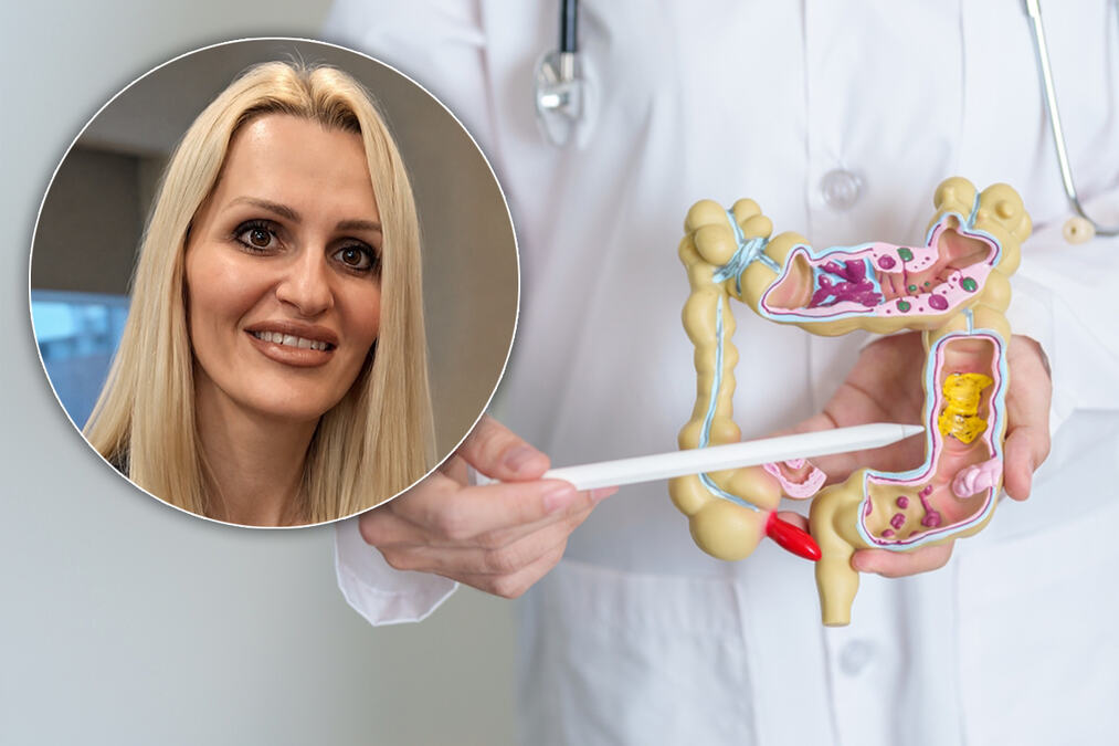 Gojaznost, manjak vlakana i neaktivnost povećavaju rizik: Kako da zaštititimo debelo crevo