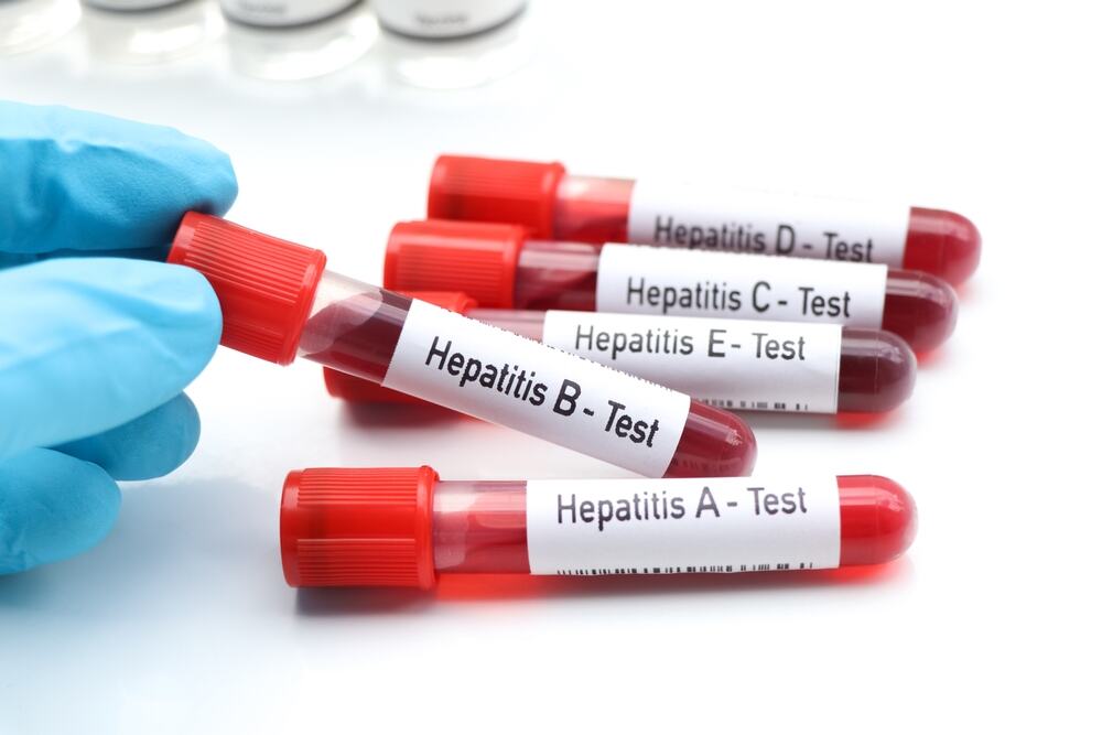 U susret Svetskom danu hepatitisa: Testiranje i lečenje ključni za zaustavljanje opasnih virusa