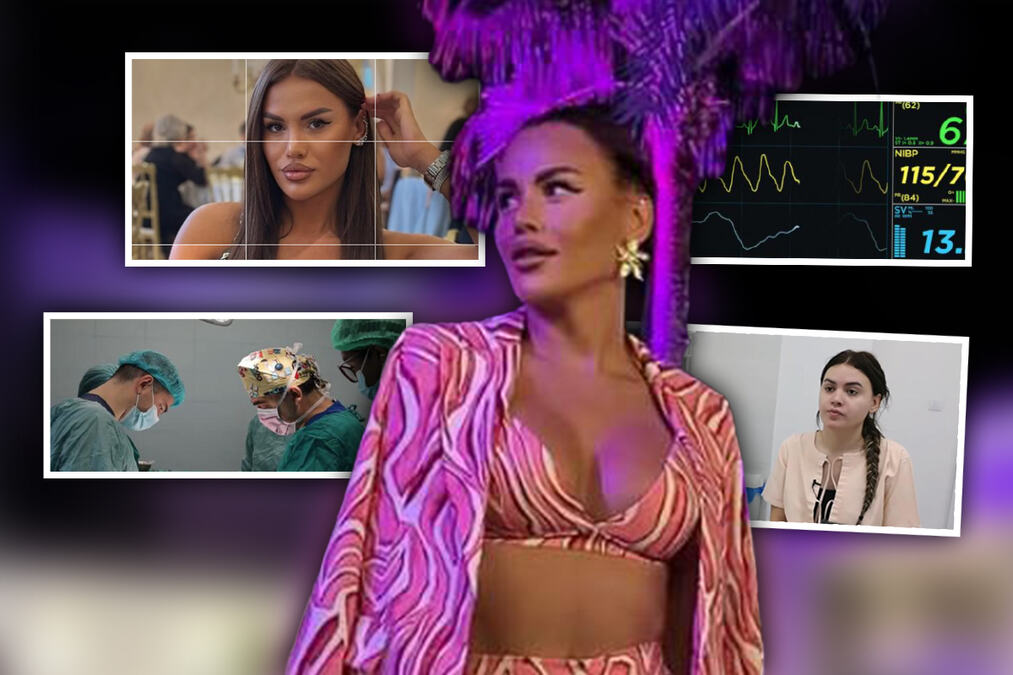 OVAKO JE IZGLEDALA OPERACIJA PROMENE POLA NIKOLINE KOVAČEVIĆ: Rodila se kao Njegoš, a danas važi za fatalnu brinetu koja mami uzdahe (FOTO)