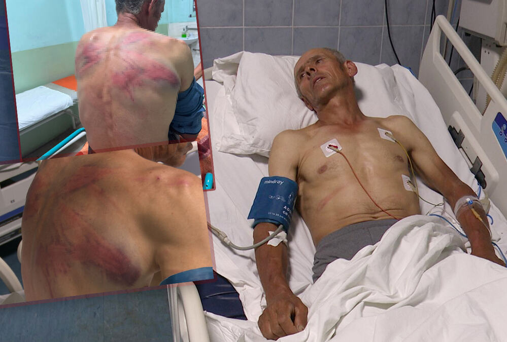 "TRAŽILI MI PUŠKU, A JA PUŠKU NEMAM" Pretučeni Srbin Nenad iz Drena na Kosmetu o detaljima krvničkog prebijanja?! (VIDEO)