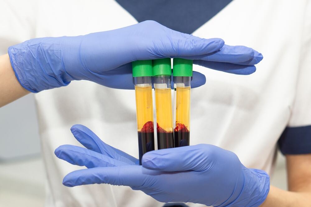 FDA odobrila prvu liofilizovanu krvnu plazmu: Spremna za transfuziju za samo 2,5 minuta i može spasiti život kod jakog krvarenja