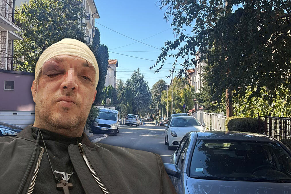 Zoran Marjanović se oglasio nakon prebijanja: "Namestili su me u stanu"