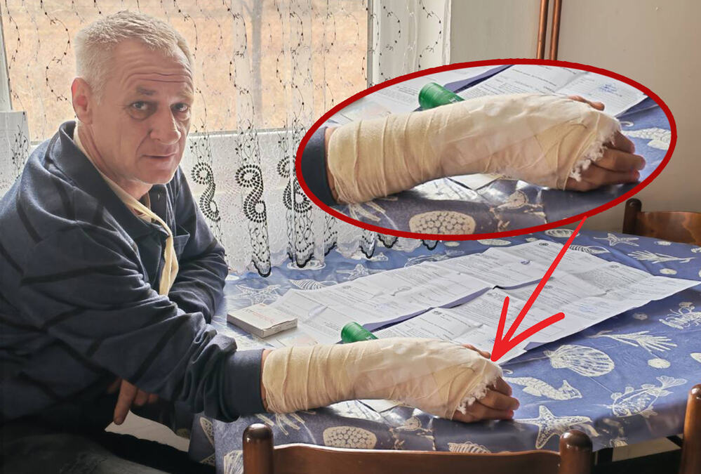Teška povreda kod Merošine: Traktorista napao vilama
