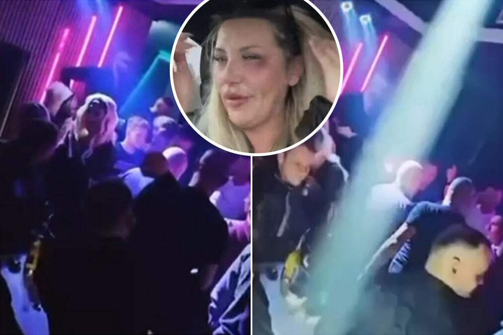 NOVI DETALJI DRAME PRETUČENE PEVAČICE! Problemi počeli pre incidenta: "Nije imala povrede, a kolegu je zakinula za novac!" (VIDEO)