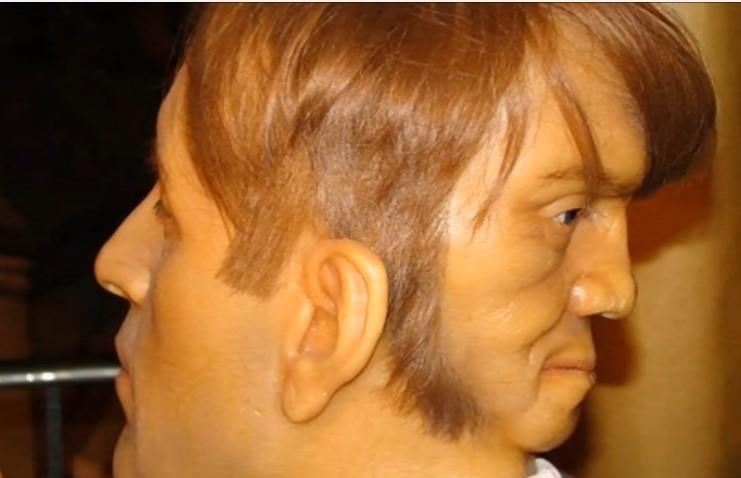 Rođen je sa licem i na potiljku, zvao ga je "đavolji blizanac": Šaputao mu je stvari dok sebi nije presudio u 23. godini