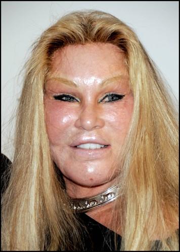Zoselyn Wildenstein profimedia-0038328809.jpg