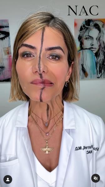 efekat botoksa 6.jpg