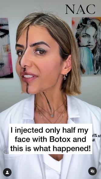 efekat botoksa 1.png