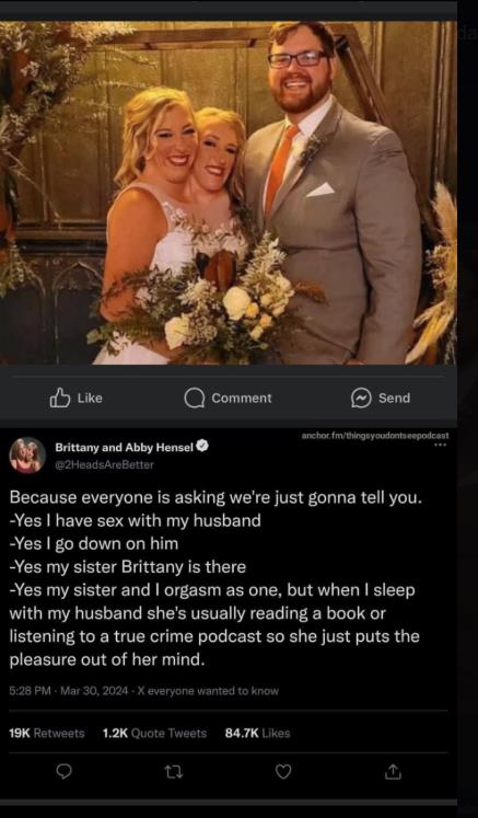 sijamske bliznakinje.jpg