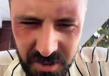 Pretučen pevač Goran Vujučić