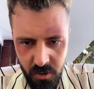 Pretučen pevač Goran Vujučić